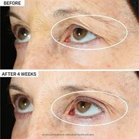 Anti Wrinkle Eye Serum