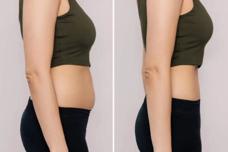 Slimming cream before and after